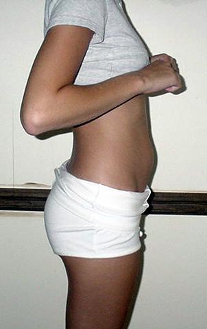 Pregnancy- West Hollywood chiropractor